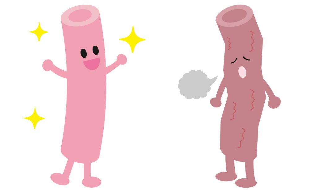 元気な血管と傷んだ血管のイラスト