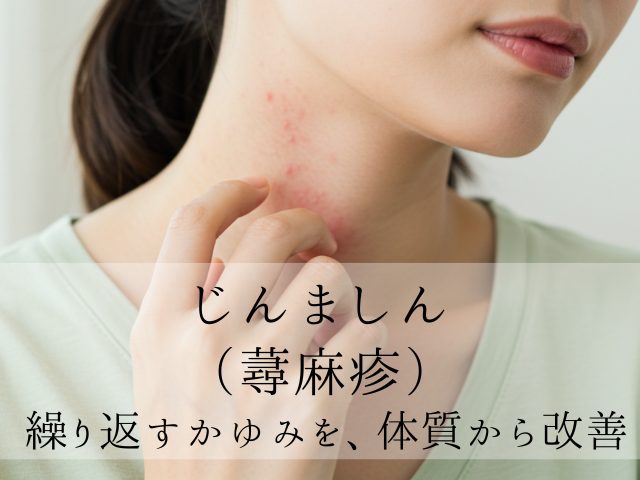 じんましん（蕁麻疹）繰り返すかゆみを、体質から改善